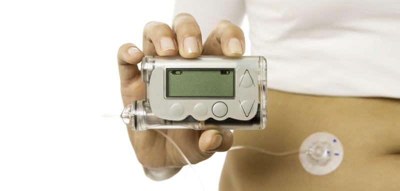 Nuevas Tecnologías en diabetes 