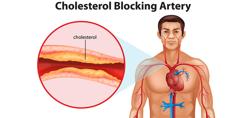 Nous fàrmacs per tractar el colesterol
