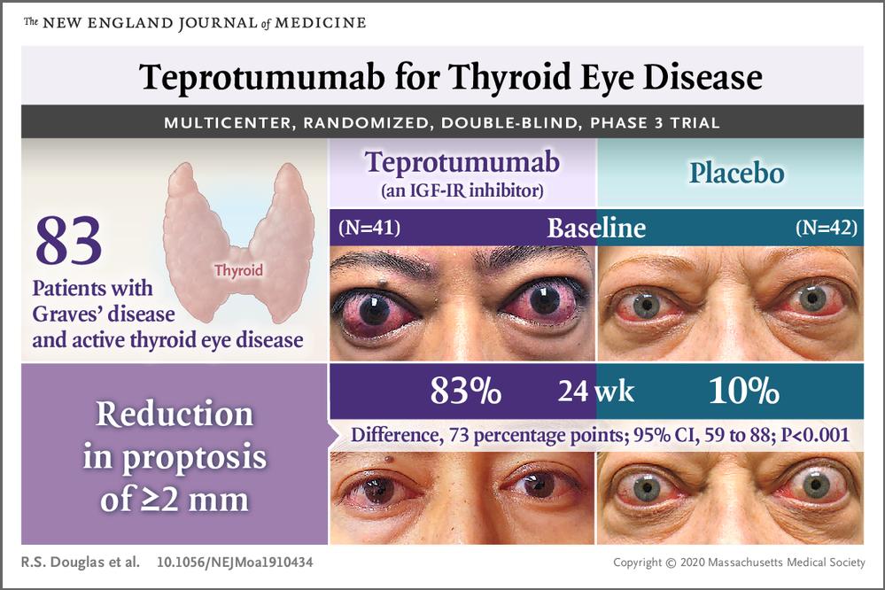 Teprotumumab: la primera medicación específicamente aprobada para tratar la enfermedad ocular tiroidea activa. 